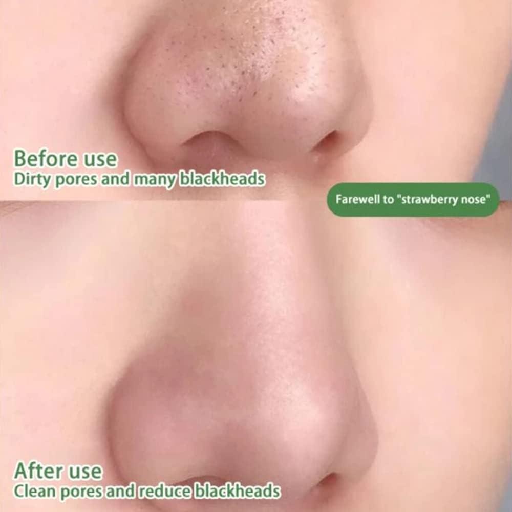 Маска за почистване на порите и контрол на акне