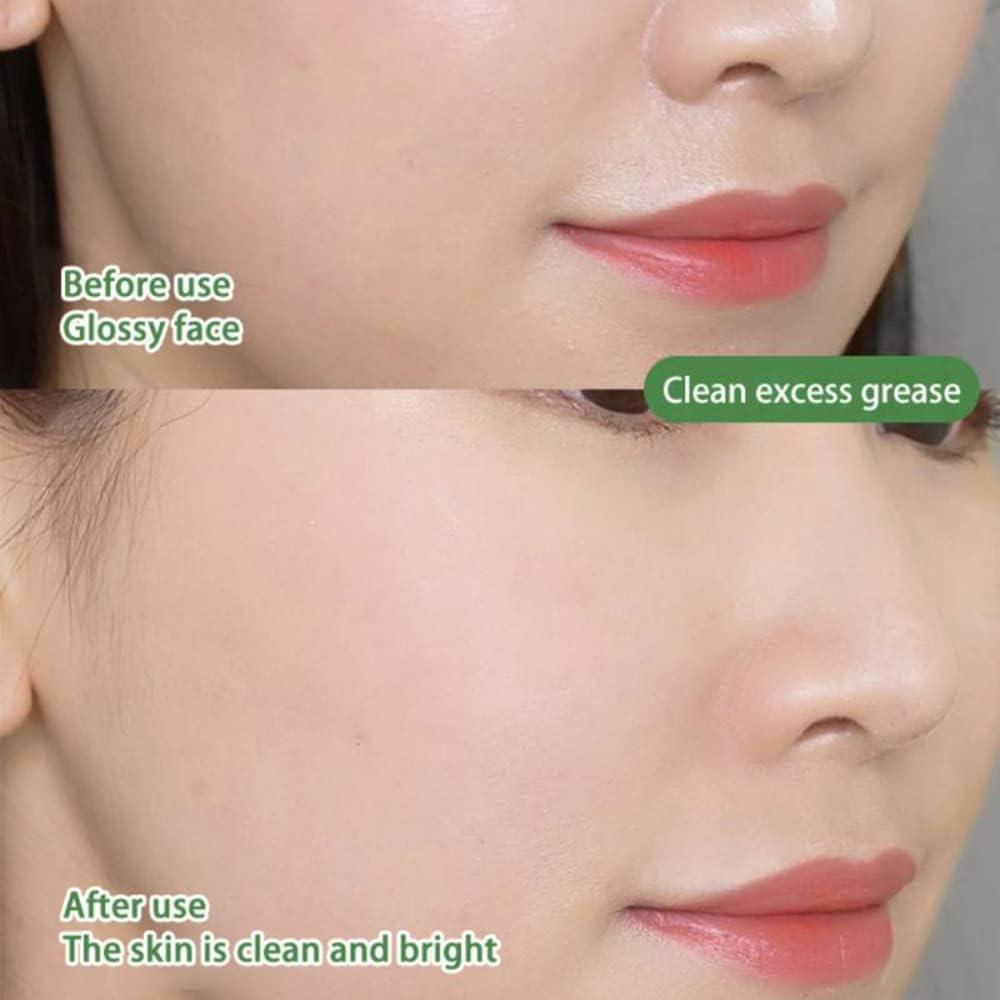 Маска за почистване на порите и контрол на акне