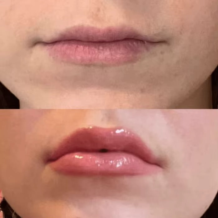 Гланц за устни с ботокс-ефект
